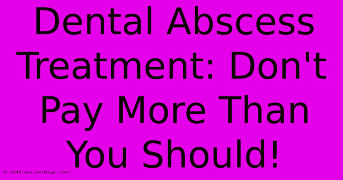 Dental Abscess Treatment: Don't Pay More Than You Should!