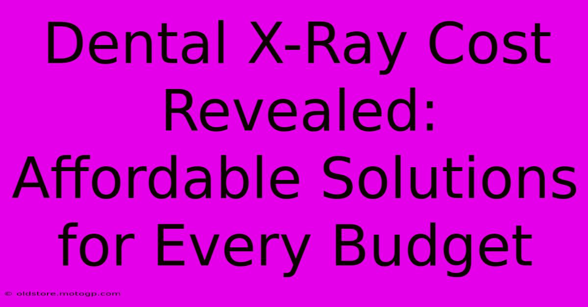 Dental X-Ray Cost Revealed: Affordable Solutions For Every Budget