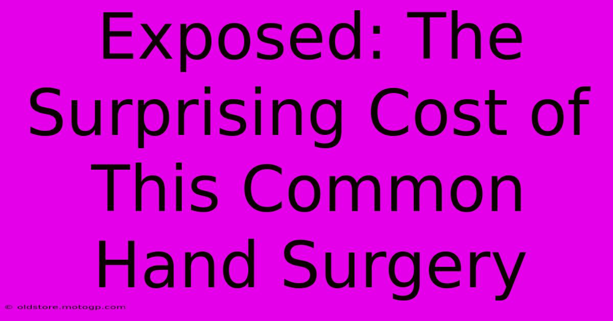 Exposed: The Surprising Cost Of This Common Hand Surgery