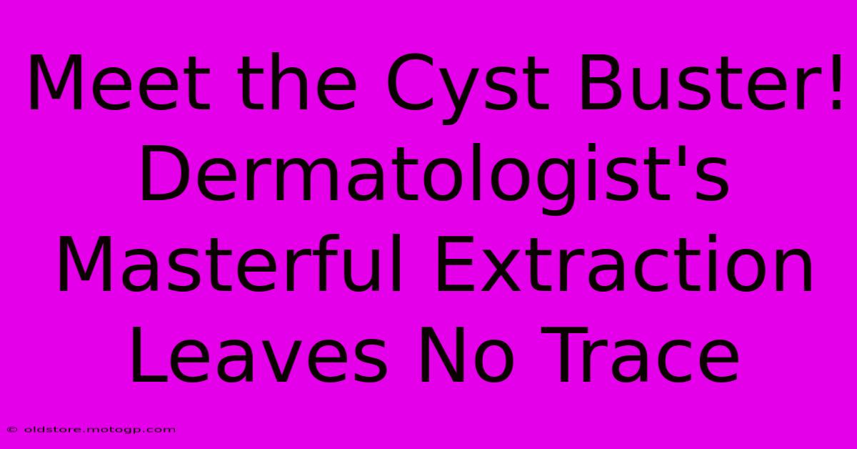 Meet The Cyst Buster! Dermatologist's Masterful Extraction Leaves No Trace