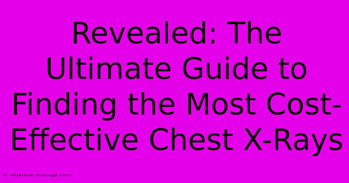 Revealed: The Ultimate Guide To Finding The Most Cost-Effective Chest X-Rays