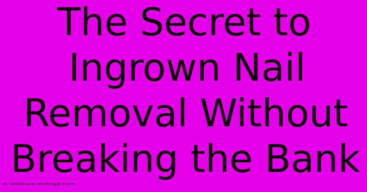 The Secret To Ingrown Nail Removal Without Breaking The Bank