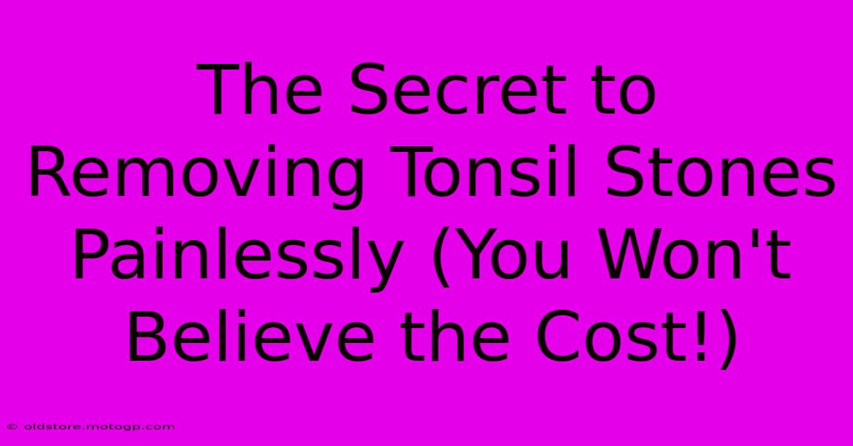 The Secret To Removing Tonsil Stones Painlessly (You Won't Believe The Cost!)