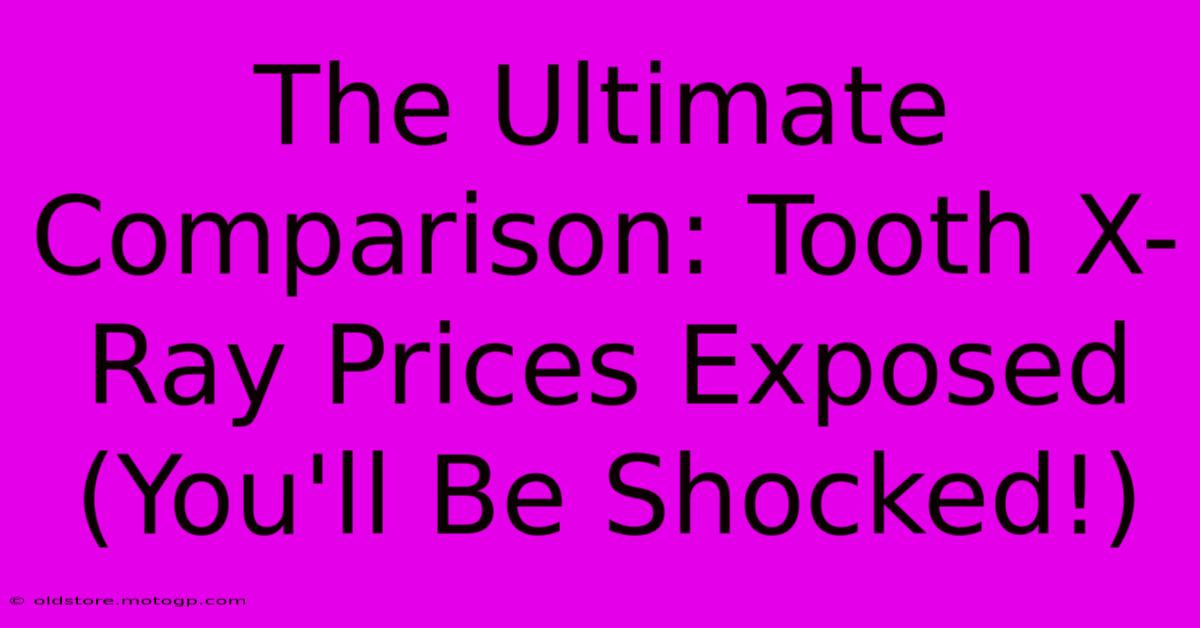 The Ultimate Comparison: Tooth X-Ray Prices Exposed (You'll Be Shocked!)