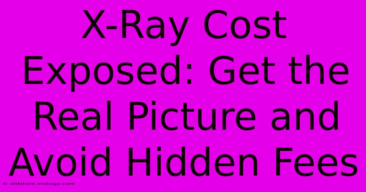 X-Ray Cost Exposed: Get The Real Picture And Avoid Hidden Fees